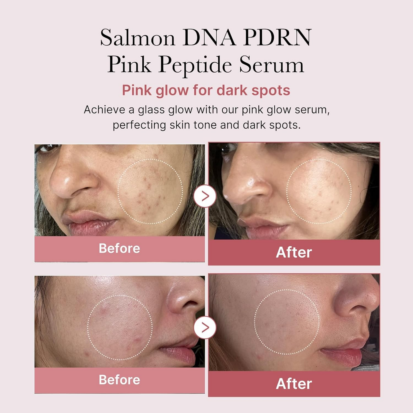 Medicube Salmon DNA PDRN ink peptide serum