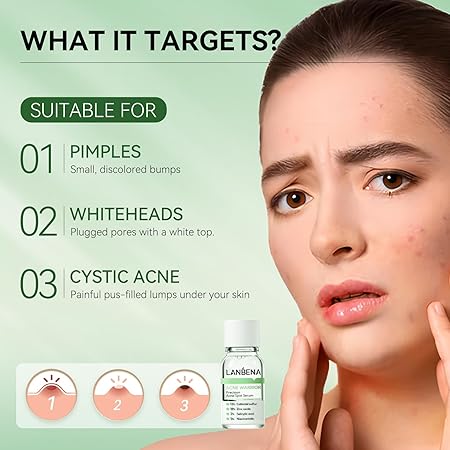 LANBENA Precision Acne Spot Serum