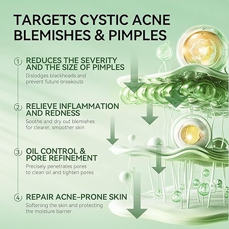 LANBENA Precision Acne Spot Serum