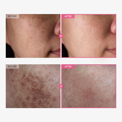 Tosowoong Arbutin 7% + Tranexamic acid 4% cream ,70,000PPM Arbutin,Niacinamide,Glutathione
