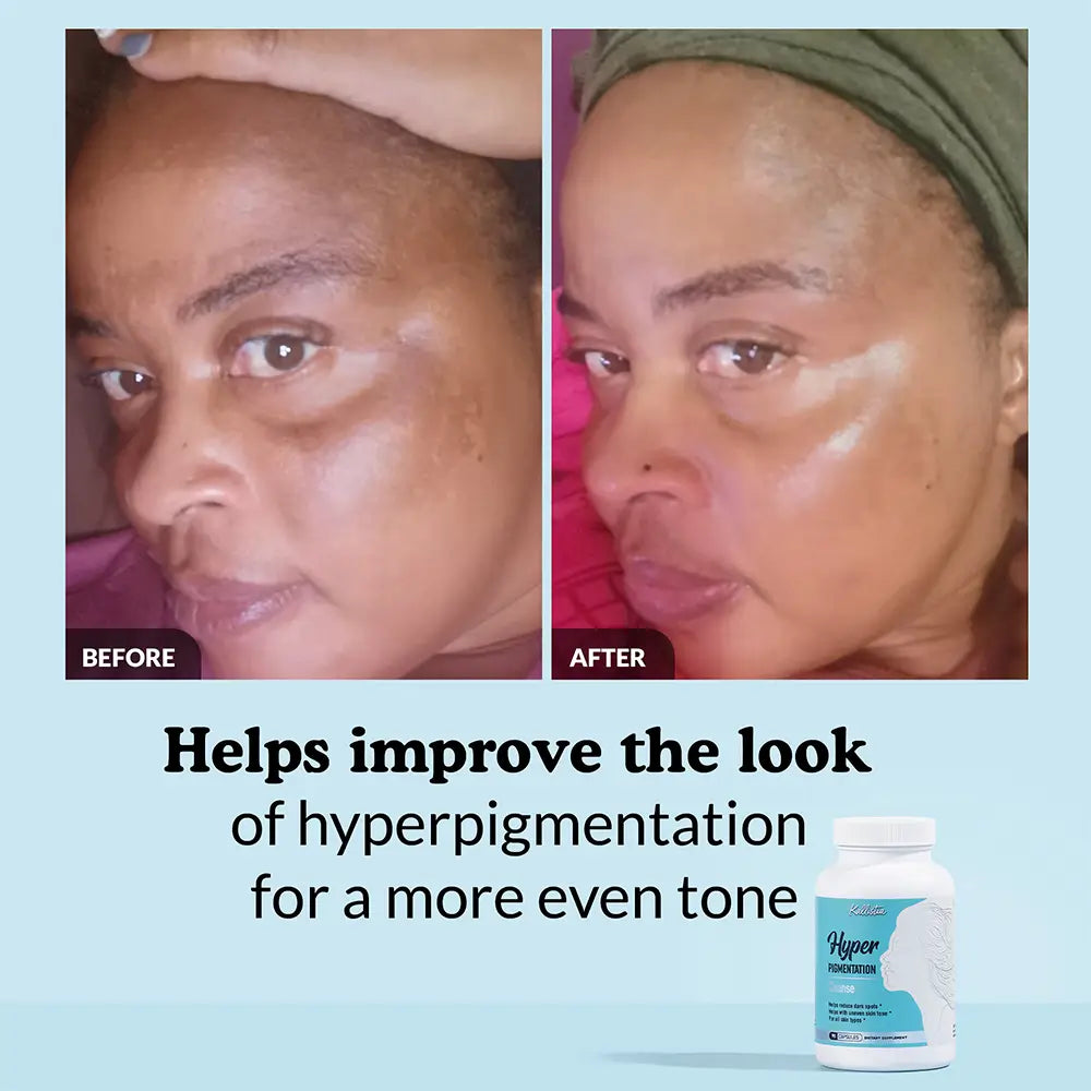 Hyperpigmentation Cleanse Capsules Kit