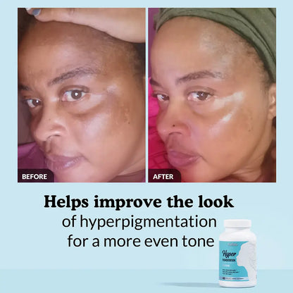 Hyperpigmentation Cleanse Capsules Kit