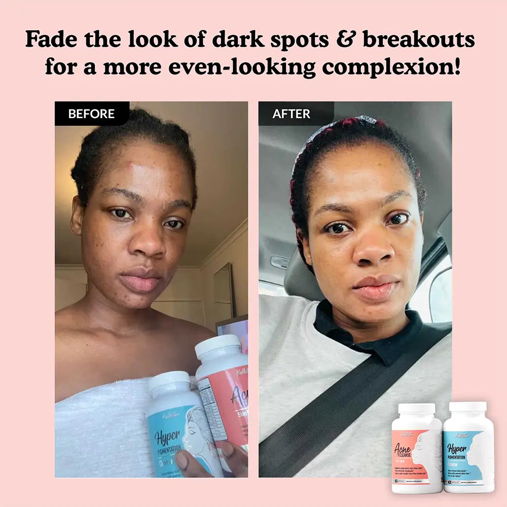 Clear Complexion Kit