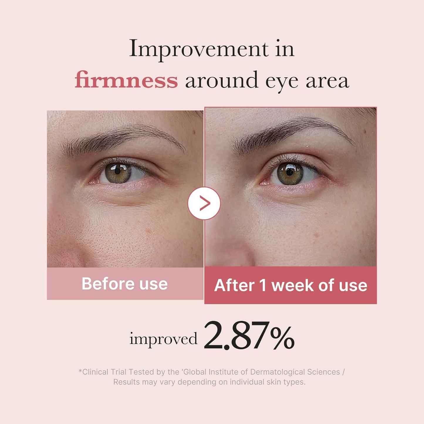 Salmon DNA PDRN pink peptide eye serum